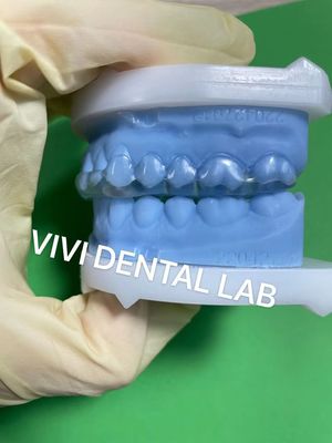 Sabit Michigan Çubukları Mükemmel Uyumlu ve Profesyonel Kaliteli Diş Çubukları