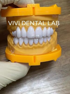 Süper Beyaz E Max Laminat Finerler Dental Profesyonel Yüksek Estetik