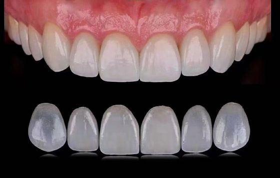 Şeffaf Emax Laminat Finerler / Porselen Diş Finerleri ISO Onaylı