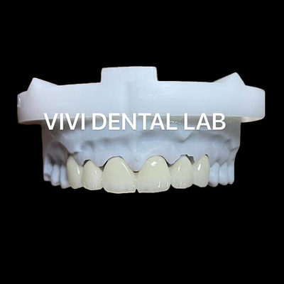 Katmanlı Dental Zirconia Taç ve Köprü Şeffaflığı 3D PRO