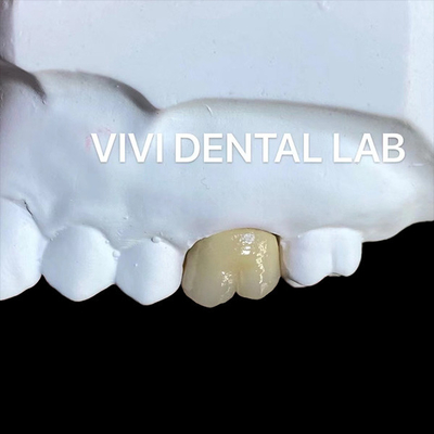 Be Ni Free Metal Porselen Taçları PFM Taç Çin Diş Laboratuarı