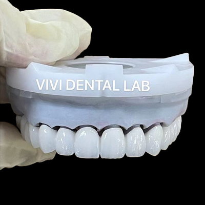 Süper Beyaz Zirkonya Diş Laboratuvar Taçları 3D PRO PFZ Noritake Porselen