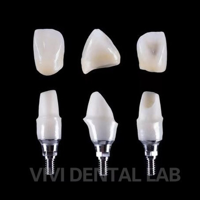 Diş İmplantı Tibase Zirkonya Abutment Titanyum Kesinlik Özel