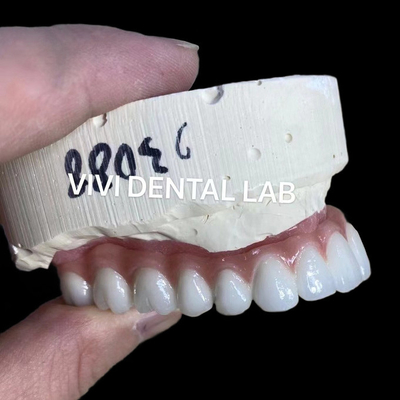 Doğal görünümlü estetik vida saklı zirkonya implant tacı uzun ömürlü