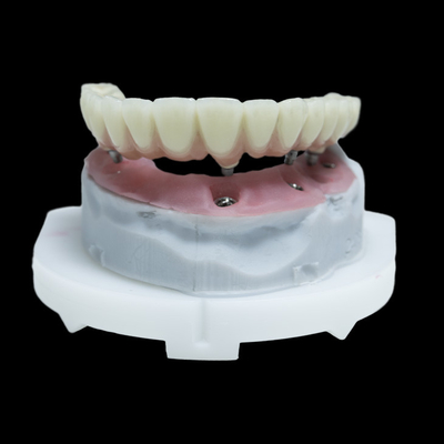 Hepsi 4 PFM Diş İmplantı Tacı Titanyum Zirkonya Hepsi 6 Restorasyon