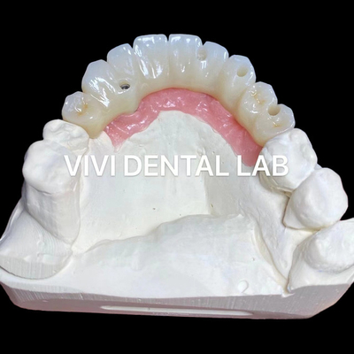 PMMA Doğruluk Tam Zirkonya Köprüsü Çok Birimli Abutments Üzerinde