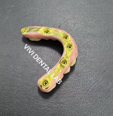 Titanyum çubuklu tam zirkonya köprüsü Çin Diş Laboratuvarı