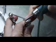 PFM Taçlar ve Köprüler