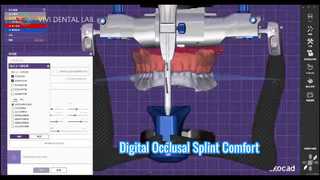Dijital Oklüzal Splint Doğru Konfor