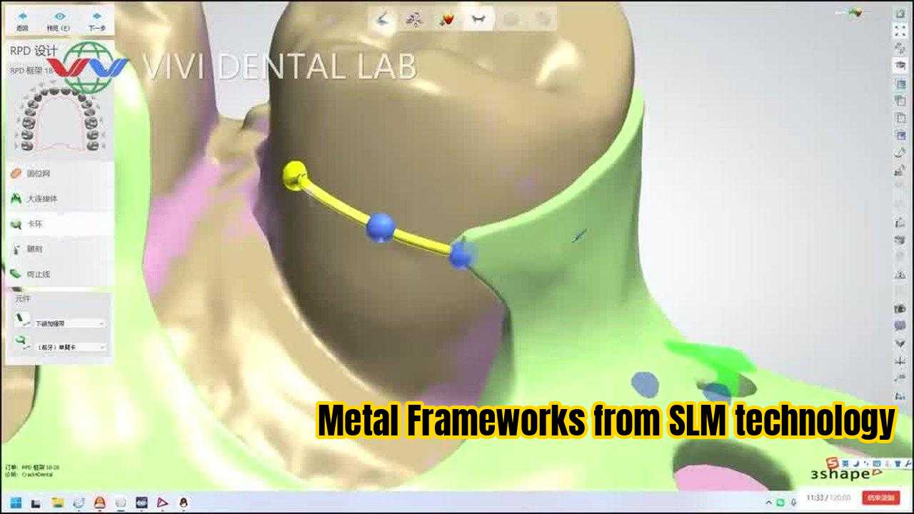 Çin VIVI DENTAI LABORATORY Sertifikalar